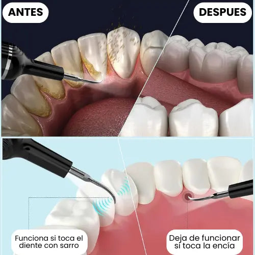 Dentlax™: Elimina el sarro, manchas y mal aliento.