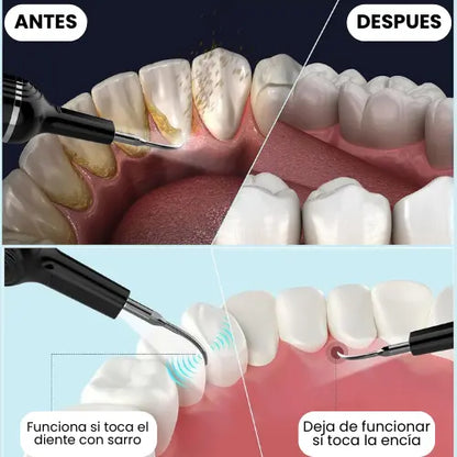 Dentlax™: Elimina el sarro, manchas y mal aliento.